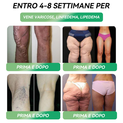 𝗡𝗲𝗴𝗼𝘇𝗶𝗼 𝘂𝗳𝗳𝗶𝗰𝗶𝗮𝗹𝗲🥇Lercea® 𝑮𝑳P-1 𝑺𝒐𝒍𝒖𝒛𝒊𝒐𝒏𝒆 𝑶𝒓𝒂𝒍𝒆 𝒑𝒆𝒓 𝒍𝒂 𝑷𝒆𝒓𝒅𝒊𝒕𝒂 𝒅𝒊 𝑷𝒆𝒔𝒐 –  𝑺𝒖𝒑𝒑𝒐𝒓𝒕𝒂 𝒐𝒃𝒆𝒔𝒊𝒕à, 𝒎𝒂𝒍𝒂𝒕𝒕𝒊𝒆 𝒄𝒂𝒓𝒅𝒊𝒐𝒗𝒂𝒔𝒄𝒐𝒍𝒂𝒓𝒊, 𝒅𝒊𝒂𝒃𝒆𝒕𝒆, 𝒂𝒑𝒏𝒆𝒂 𝒏𝒐𝒕𝒕𝒖𝒓𝒏𝒂, 𝒑𝒓𝒐𝒃𝒍𝒆𝒎𝒊 𝒂𝒓𝒕𝒊𝒄𝒐𝒍𝒂𝒓𝒊 𝒆 𝒂𝒍𝒕𝒓𝒐 𝒂𝒏𝒄𝒐𝒓𝒂🌈