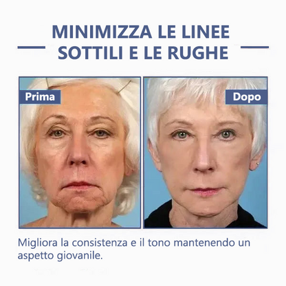 🔥🩵Sconto ultimo giorno: 75% di sconto🌸𝐅𝐮𝐛𝐬𝐭𝐚® Crema avanzata rassodante e antirughe: Ripristina l'elasticità della pelle