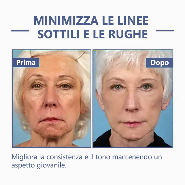 ☄️Sconto ultimo giorno: 75% di sconto☄️𝐅𝐮𝐛𝐬𝐭𝐚® Crema avanzata rassodante e antirughe: Ripristina l'elasticità della pelle