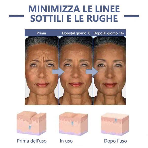 🔥🩵Sconto ultimo giorno: 75% di sconto🌸𝐅𝐮𝐛𝐬𝐭𝐚® Crema avanzata rassodante e antirughe: Ripristina l'elasticità della pelle