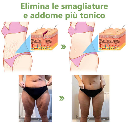 Ultimo Giorno di Sconto: 80% DI SCONTO 🫧 Crema Avanzata Fubsta® Rassodante e Anti-Rughe: Ripristina l’Elasticità della Pelle