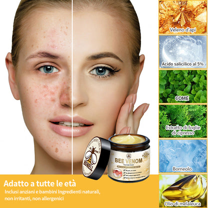 ULTIMO GIORNO 80% di sconto su BSWELL™ Bee Venom Skin Cream🌺 (raccomandato da AAD)