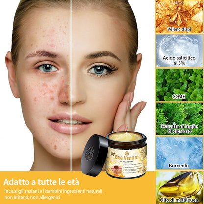 Crema🐝 per il trattamento della pelle al veleno d'api Turonu™ (consigliata AAD) (🔥promozione dell'ultimo giorno 80% di sconto)