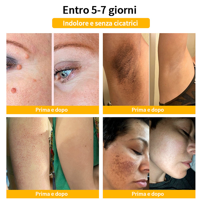 Crema🐝 per il trattamento della pelle al veleno d'api Turonu™ (consigliata AAD) (🔥promozione dell'ultimo giorno 80% di sconto)