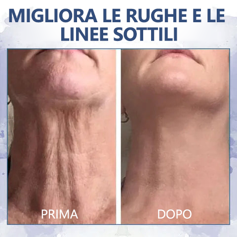 🔥🩵Sconto ultimo giorno: 75% di sconto🌸𝐅𝐮𝐛𝐬𝐭𝐚® Crema avanzata rassodante e antirughe: Ripristina l'elasticità della pelle