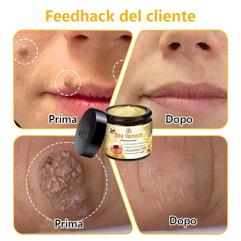 Crema🐝 per il trattamento della pelle al veleno d'api Turonu™ (consigliata AAD) (🔥promozione dell'ultimo giorno 80% di sconto)