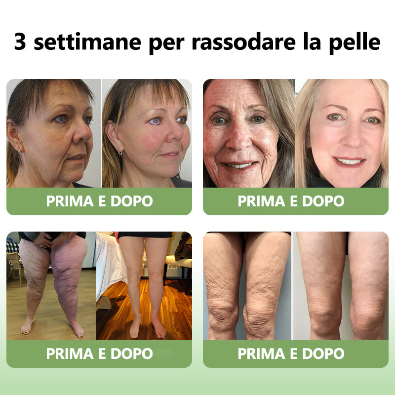 Ultimo Giorno di Sconto: 80% DI SCONTO 🫧 Crema Avanzata Fubsta® Rassodante e Anti-Rughe: Ripristina l’Elasticità della Pelle