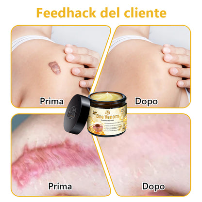 Crema🐝 per il trattamento della pelle al veleno d'api Turonu™ (consigliata AAD) (🔥promozione dell'ultimo giorno 80% di sconto)