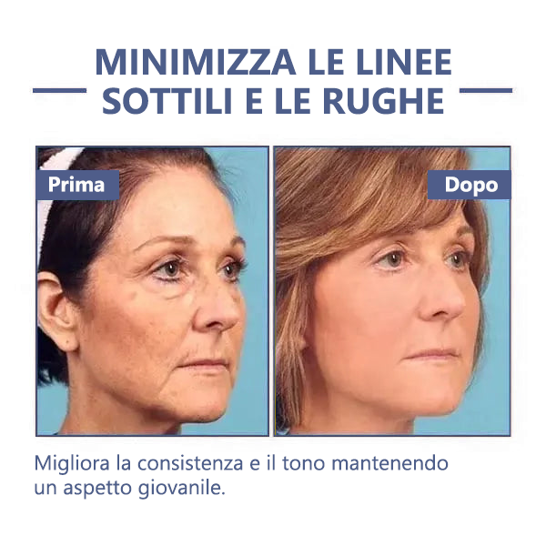 🔥🩵Sconto ultimo giorno: 75% di sconto🌸𝐅𝐮𝐛𝐬𝐭𝐚® Crema avanzata rassodante e antirughe: Ripristina l'elasticità della pelle