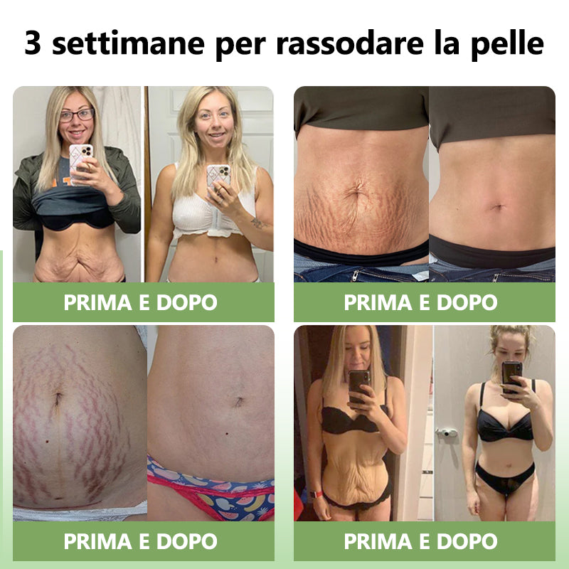 Ultimo Giorno di Sconto: 80% DI SCONTO 🫧 Crema Avanzata Fubsta® Rassodante e Anti-Rughe: Ripristina l’Elasticità della Pelle