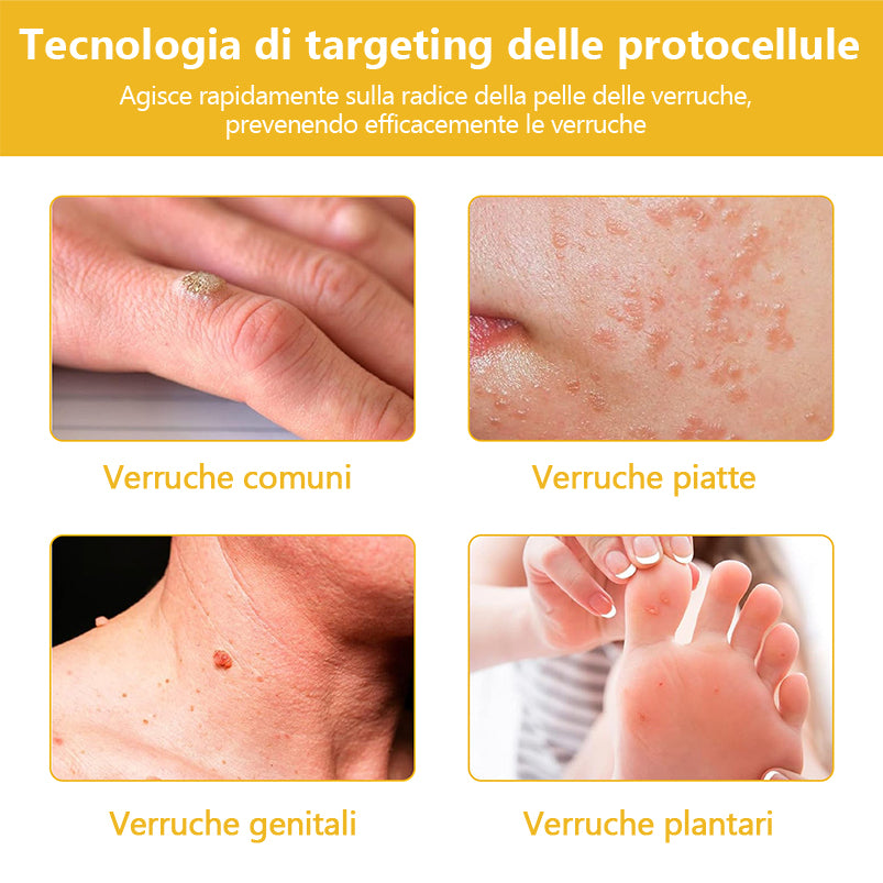 Crema🐝 per il trattamento della pelle al veleno d'api Turonu™ (consigliata AAD) (🔥promozione dell'ultimo giorno 80% di sconto)