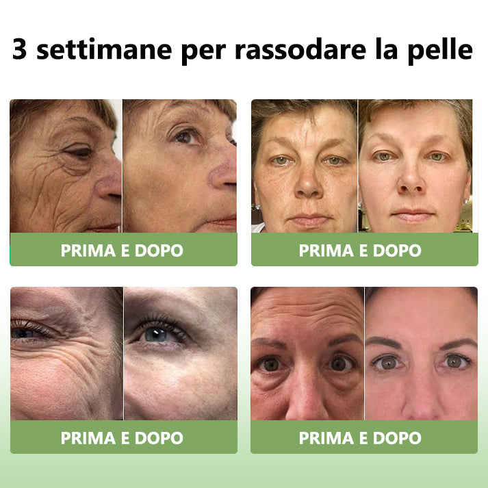 Ultimo Giorno di Sconto: 80% DI SCONTO 🫧 Crema Avanzata Fubsta® Rassodante e Anti-Rughe: Ripristina l’Elasticità della Pelle