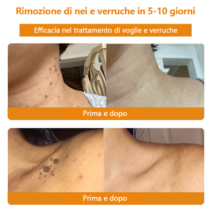 Crema🐝 per il trattamento della pelle al veleno d'api Turonu™ (consigliata AAD) (🔥promozione dell'ultimo giorno 80% di sconto)