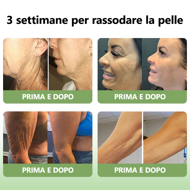 Ultimo Giorno di Sconto: 80% DI SCONTO 🫧 Crema Avanzata Fubsta® Rassodante e Anti-Rughe: Ripristina l’Elasticità della Pelle