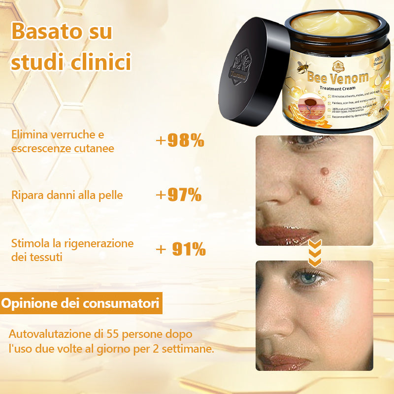 Crema🐝 per il trattamento della pelle al veleno d'api Turonu™ (consigliata AAD) (🔥promozione dell'ultimo giorno 80% di sconto)