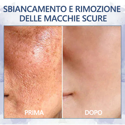 🔥🩵Sconto ultimo giorno: 75% di sconto🌸𝐅𝐮𝐛𝐬𝐭𝐚® Crema avanzata rassodante e antirughe: Ripristina l'elasticità della pelle