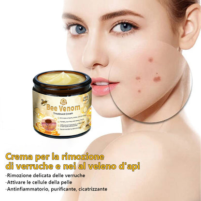 Crema🐝 per il trattamento della pelle al veleno d'api Turonu™ (consigliata AAD) (🔥promozione dell'ultimo giorno 80% di sconto)