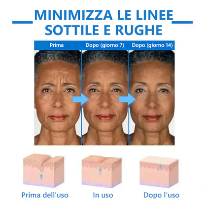 Stimola le cellule della pelle🌐Fubsta® Crema rassodante e ringiovanente avanzata: ripristina l'elasticità della pelle 🎁 (Ultimo giorno: 70% di sconto)