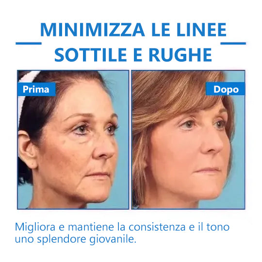 Stimola le cellule della pelle🌐Fubsta® Crema rassodante e ringiovanente avanzata: ripristina l'elasticità della pelle 🎁 (Ultimo giorno: 70% di sconto)