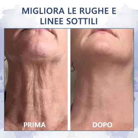 Stimola le cellule della pelle🌐Fubsta® Crema rassodante e ringiovanente avanzata: ripristina l'elasticità della pelle 🎁 (Ultimo giorno: 70% di sconto)