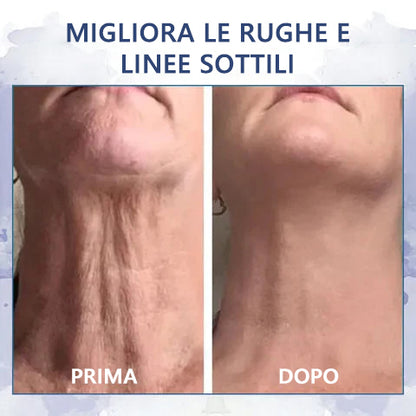 Stimola le cellule della pelle🌐Fubsta® Crema rassodante e ringiovanente avanzata: ripristina l'elasticità della pelle 🎁 (Ultimo giorno: 70% di sconto)