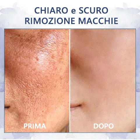 Stimola le cellule della pelle🌐Fubsta® Crema rassodante e ringiovanente avanzata: ripristina l'elasticità della pelle 🎁 (Ultimo giorno: 70% di sconto)